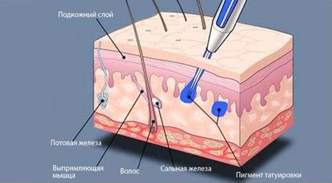 Нанесение татуировки под кожу